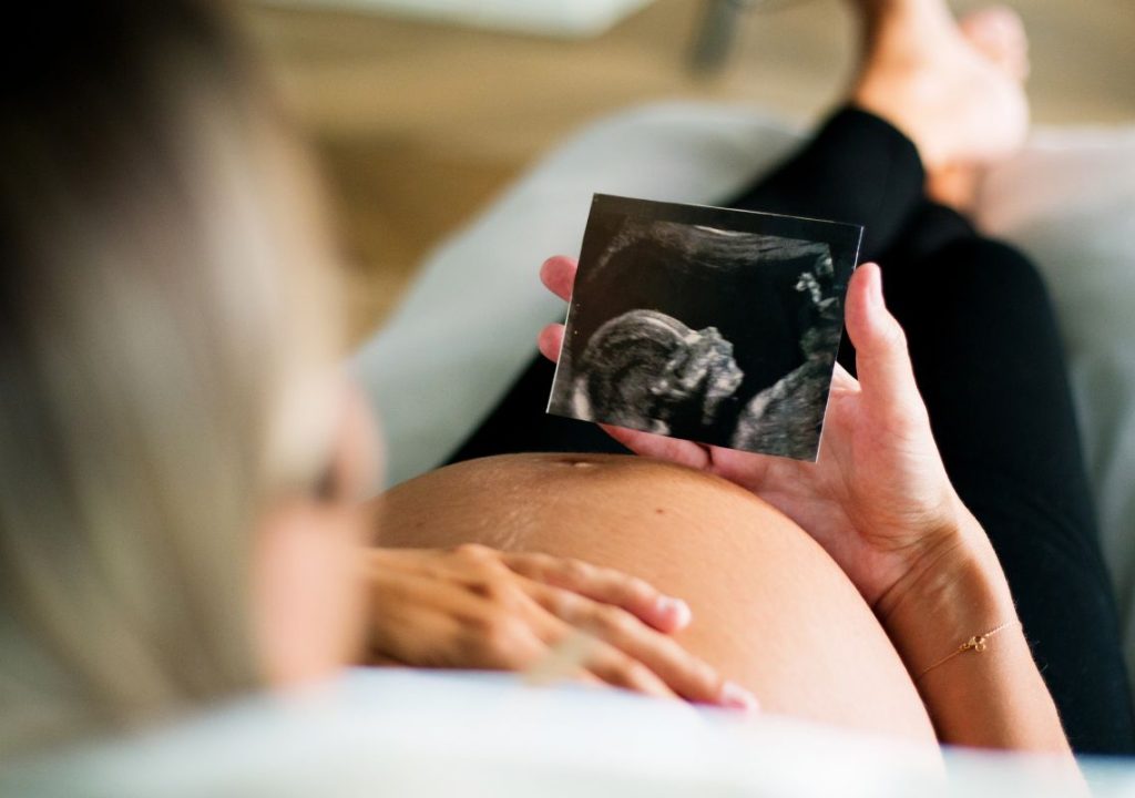 
strije krema za strije krema protiv strija strije na stomaku uklanjanje strija plantigo prirodna kozmetika
